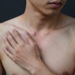 데오드란트 부작용으로 인한 겨드랑이 피부 자극과 붉어짐