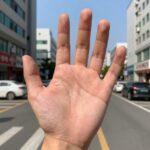 땀이 많이 나는 이유와 관리법 땀이 많이 나는 이유를 설명하는 다한증 환자의 손바닥 땀 이미지