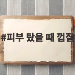 피부 탔을 때 껍질 진정시키는 법 피부 탔을 때 껍질