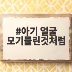 아기 얼굴 모기물린것처럼 대처법 아기 얼굴 모기물린것처럼